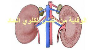 الفشل الكلوي الحاد