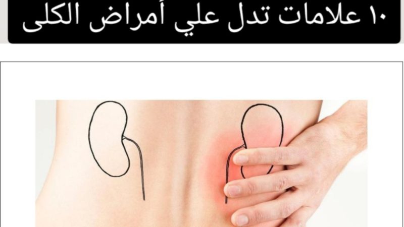 بداية مرض الكلى: ١٠ علامات تدل علي أمراض الكلى