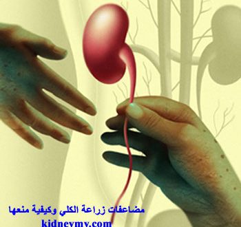 مضاعفات زراعة الكلي