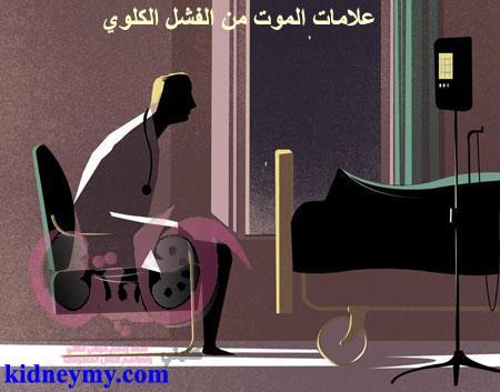 علامات الموت من الفشل الكلوي اليك اليك بالتفصيل متي يموت مريض الفشل الكلوي