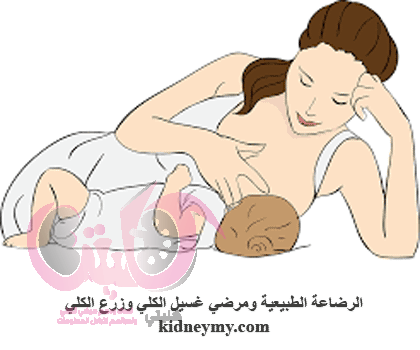 الرضاعة الطبيعية ومرضي الكلي