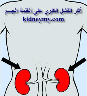 آثار الفشل الكلوي على أعضاء الجسم الحيوية
