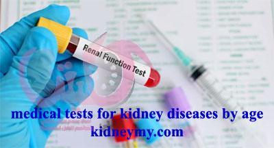 الفحوصات الطبية لأمراض الكلى كل سنة حسب العمر