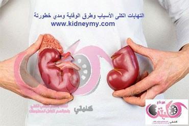 ما هي أعراض التهابات الكلي وعلاجها؟