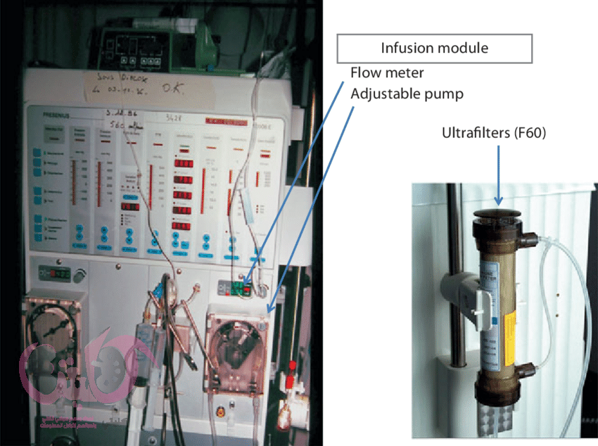 غسيل كلى جديد وأفضل عالي الكفاءة فائق الترشيح haemofiltration