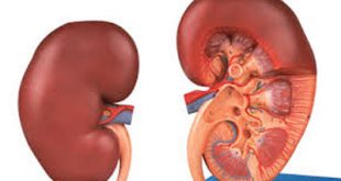 uremia أورميا , تبولن الدم