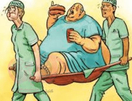 Tips to protect kidney transplant patients from obesity