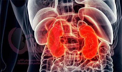أعراض التهاب الكلى المتكرر وآخر ما توصل إليه الطب في التشخيص والوقاية
