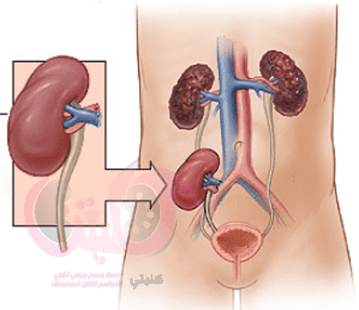 أخر ما توصل الطب في جراحة زراعة الكلى