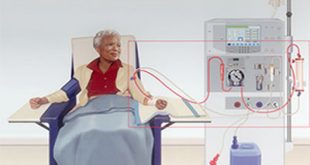 Dialysis is necessary at a given time in our lives