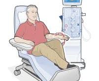 Dialysis Information you need to know