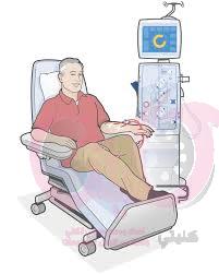 Dialysis: Information you need to know