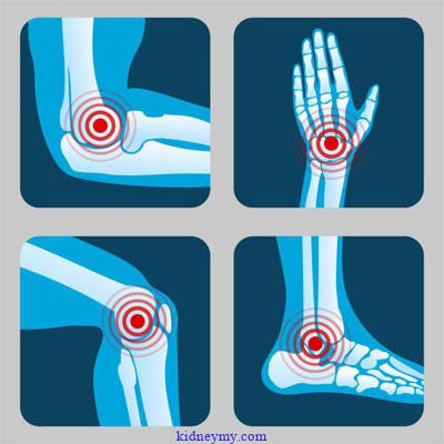 Three foods may be responsible for joint pain