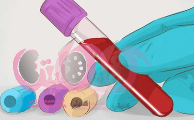 تحليل glomerular filtration rate