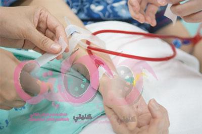 اسباب تضيق الوصلة الوريدية الشريانية