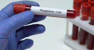 علاج ارتفاع الفوسفور في الدم