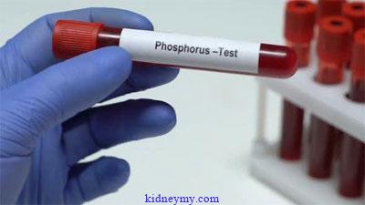 علاج ارتفاع الفوسفور في الدم لمرضي الكلي بالحمية الغذائية والادوية