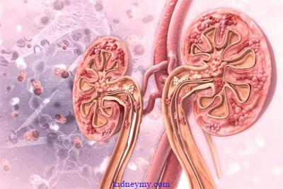 غسيل الكلى للصائم في نهار رمضان والإجابة على سؤال آلاف المرضى: هل غسيل الكلى يفطر أم لا؟