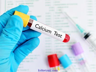 دليل الكالسيوم لمرضي الكلى المزمن والكمية التي يحتاجها مريض الكلى