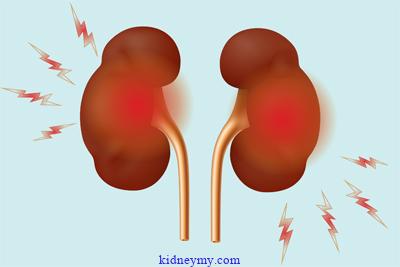 المضادات الحيوية مناسبة للمرضى الذين لديهم حساسية من البنسلين
