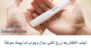 انجاب الأطفال بعد زرع الكلي سؤال وجواب لما يهمك معرفتة
