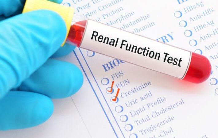 ما هي تحاليل امراض الكلي؟ شرح مبسط لتحاليل وظائف الكلى