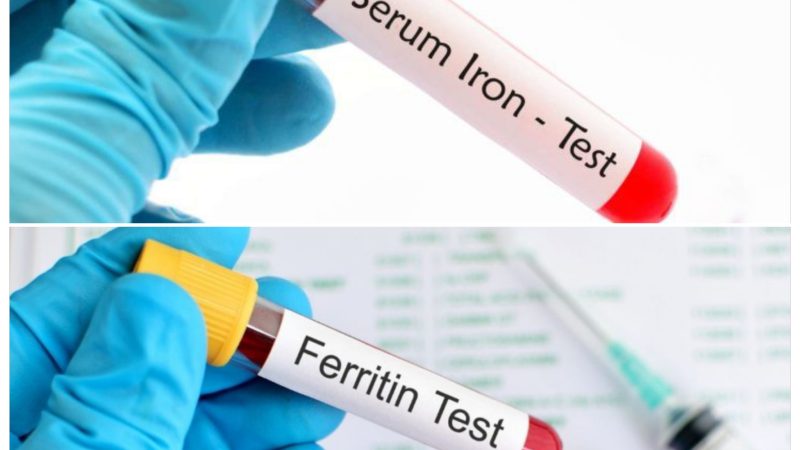 ما هو الفرق بين iron و ferritin وايهما أدق