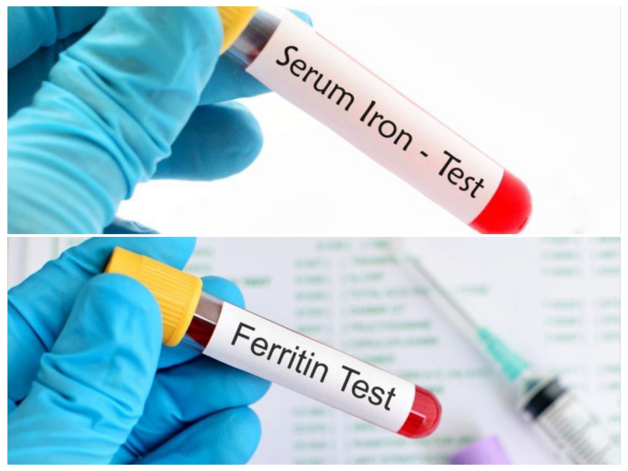 ما هو الفرق بين iron و ferritin وايهما أدق