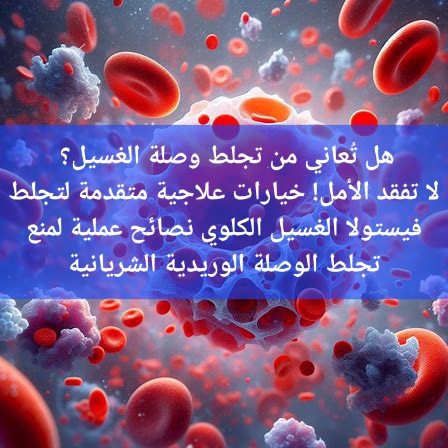 علاج تجلط الدم: استعيد تدفق الدم في وصلة الغسيل الكلوي