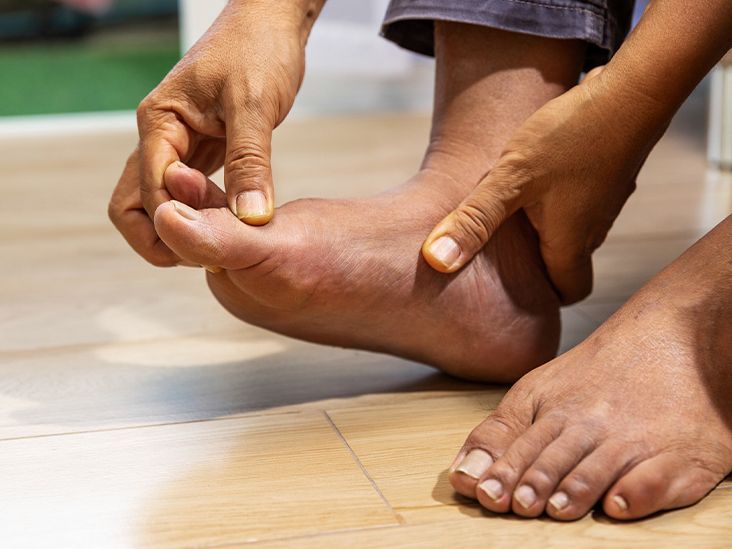 هل النقرس له تأثير علي الكلى؟