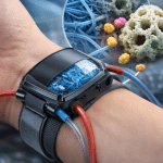 علاج الفشل الكلوي غسيل الكلى البريتوني وغسيل الكلى الدموي