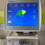 معلومات عن تقنية OL-HDF