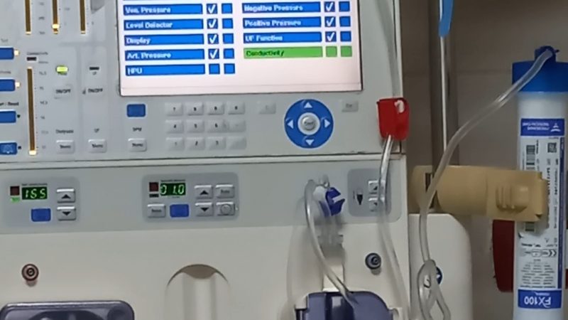 التحديات الصامتة: 7 مضاعفات غسيل الكلى طويلة المدي وقاية وعلاج