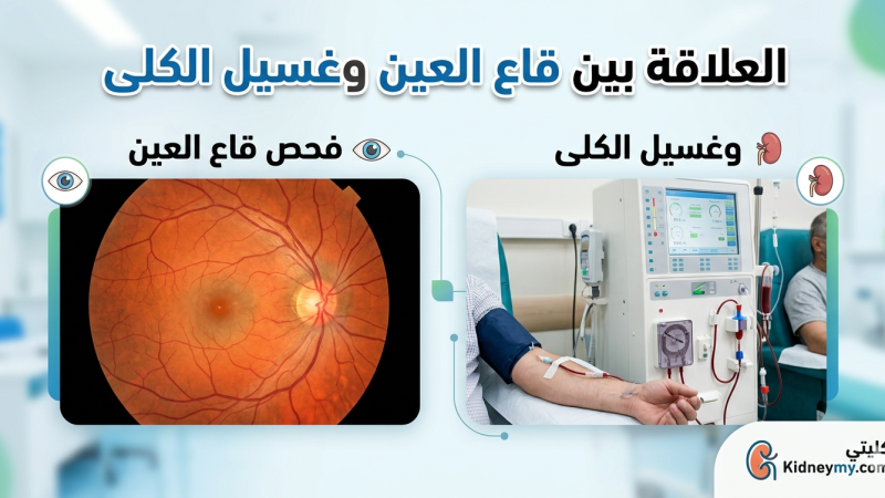 قاع العين وغسيل الكلى: كيف يؤثر غسيل الكلى على صحة العيون لمريض الغسيل؟