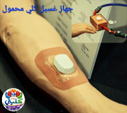 جهاز غسيل كلى محمول: ابتكار ياباني في حالات الطوارئ والكوارث الطبيعية
