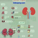 علاج نسبة الكرياتينين 10 بالدم